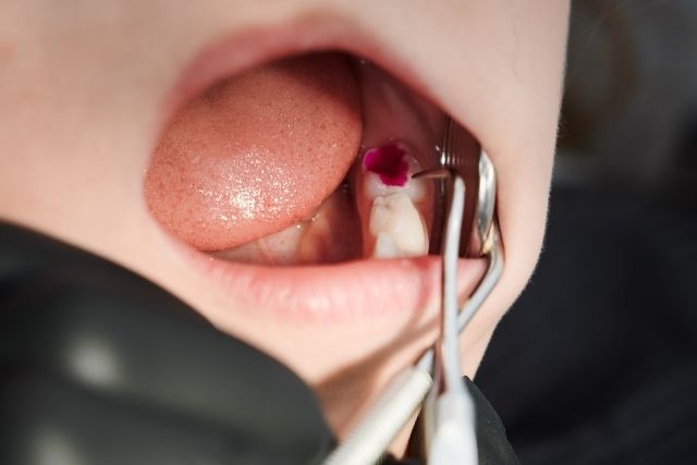 contact us apple dent