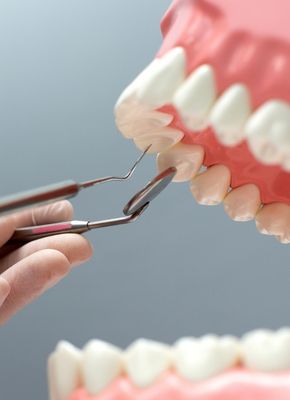 apple dent teeth surgery